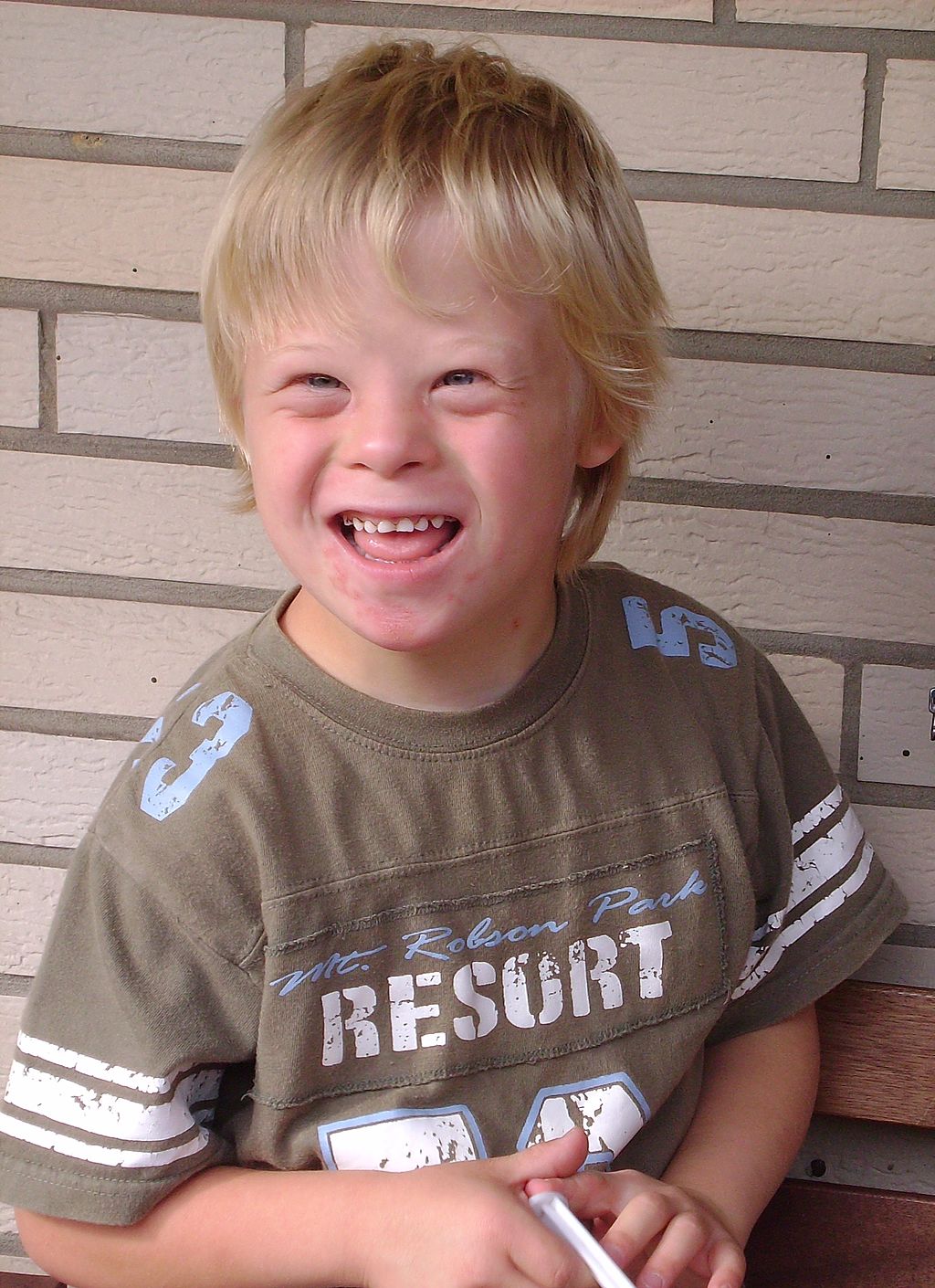 Image shows an image of a young boy with Down Syndrome.