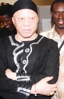 Example of a human displaying albinism