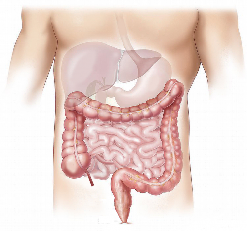 Large intestine