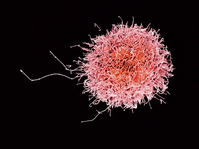 Natural Killer Cell