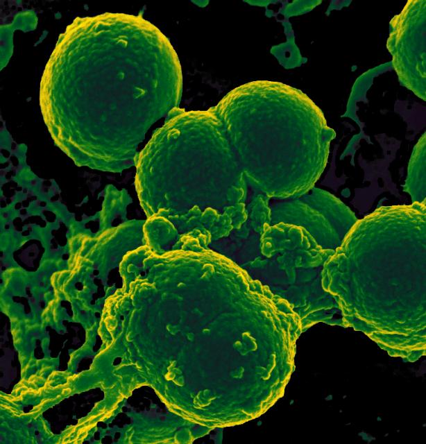 Neutrophil