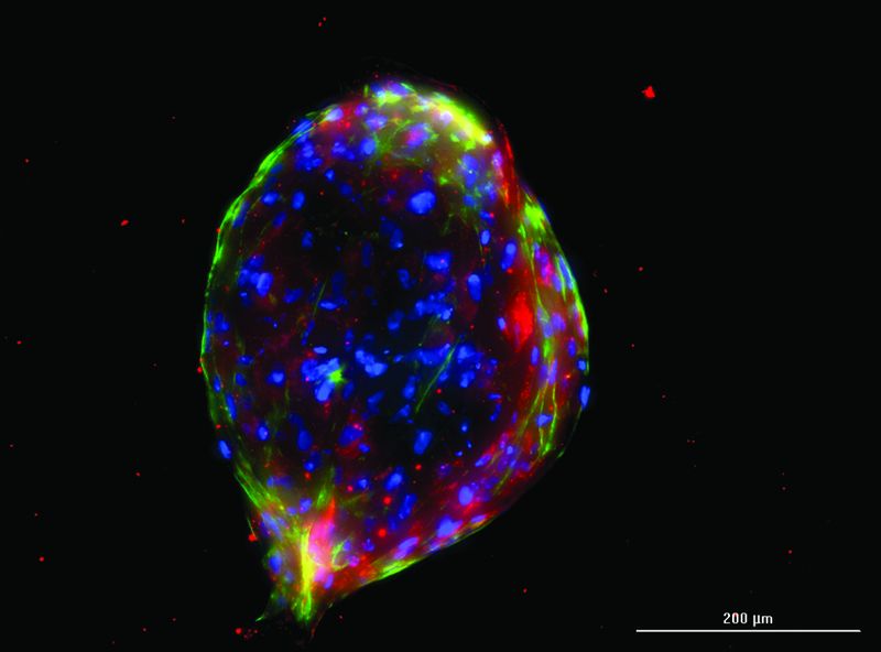 Chondrocyte: a cartilage producing cell