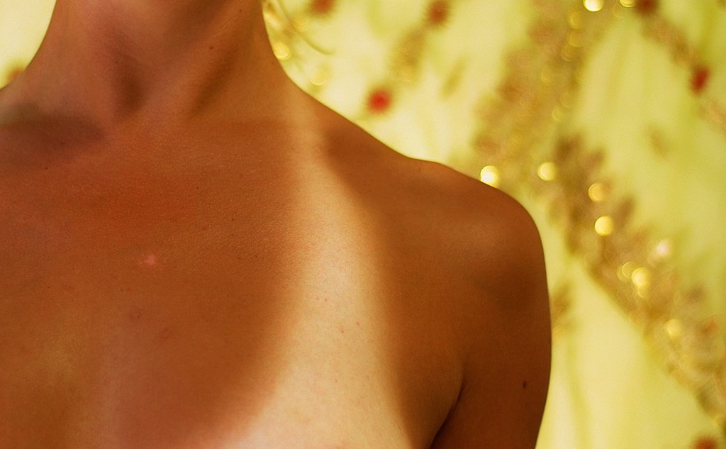 https://commons.wikimedia.org/wiki/File:Tan_lines_on_human_female_chest.jpg