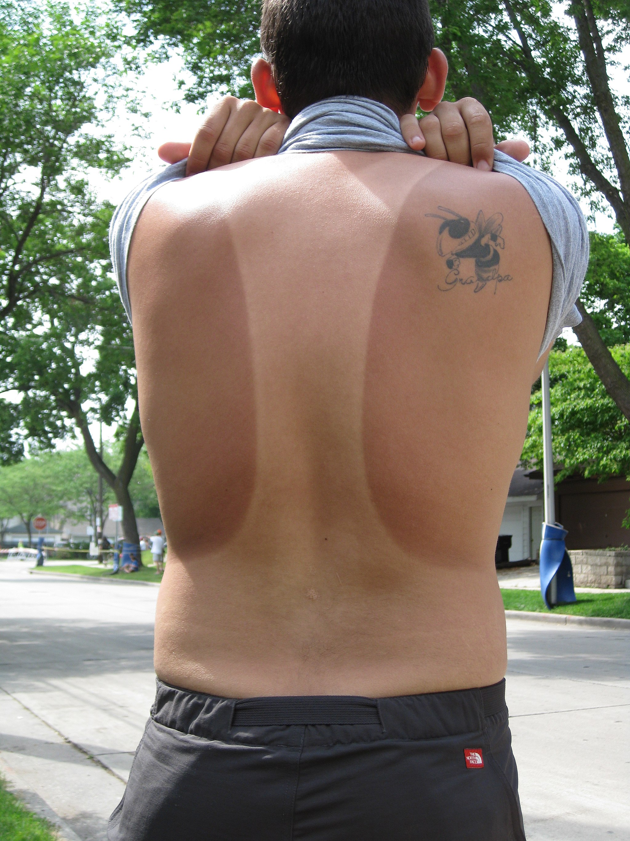 https://commons.wikimedia.org/wiki/File:Tan_Lines_on_human_male_back.jpg