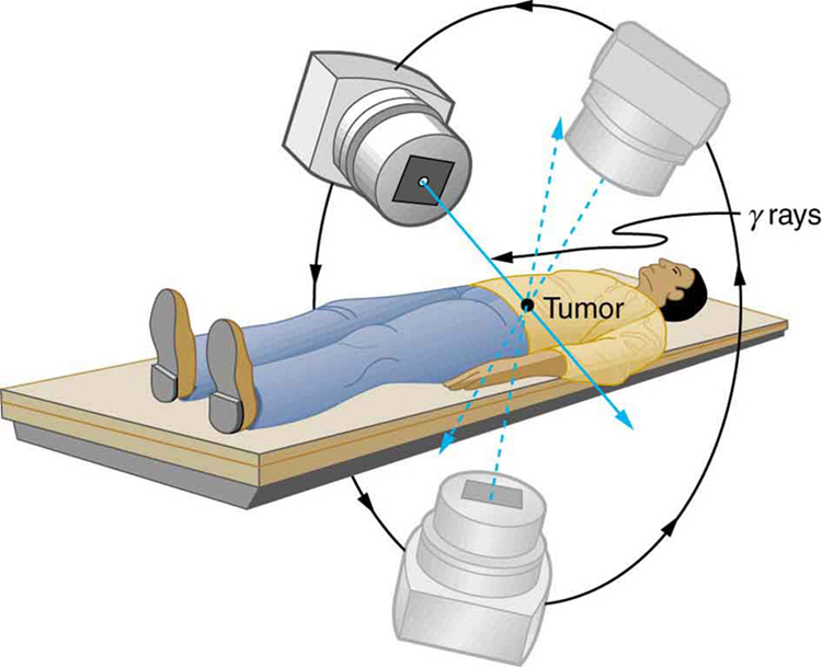 The image shows a man lying on a flat surface. A gamma ray machine is rotated around the man.